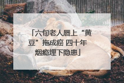 六旬老人唇上“黄豆”拖成癌 四十年烟瘾埋下隐患